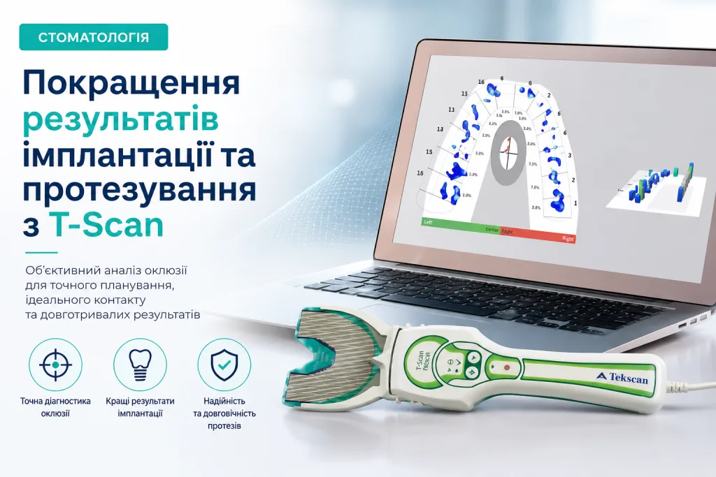 Покращення результатів імплантації та протезування з T-Scan