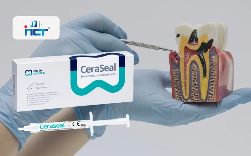 Gloved hands hold a syringe and a box labeled CeraSeal bioceramic root canal sealer beside a cross‑section of a tooth model, showing dental materials for root canals.